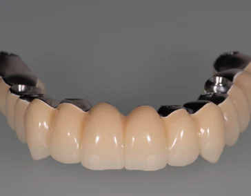 Балочная конструкция 